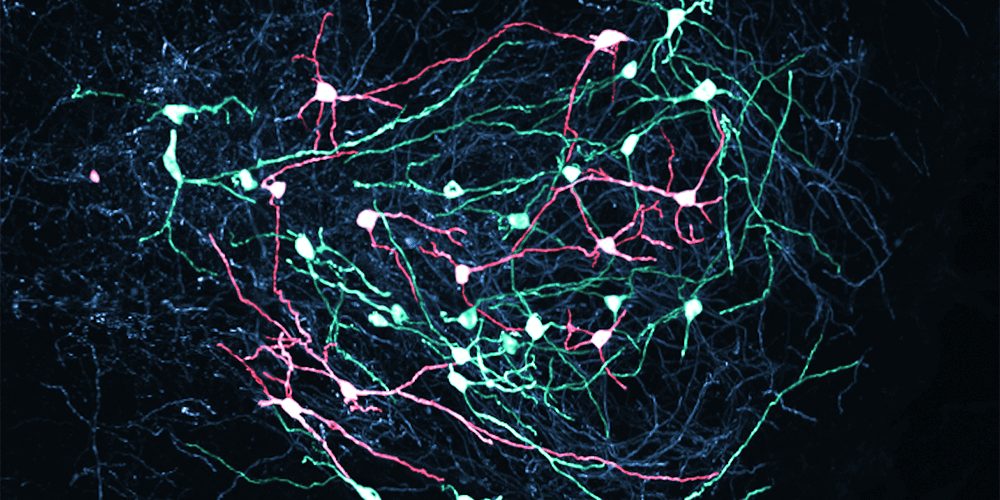 SNr neurons in the midbrain send precise signals to control movement. Their activity determines which movements actions are initiated or inhibited.